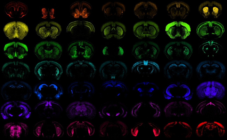 &laquo;Google для мозга&raquo;: учёным открыли единую ИИ-систему для сравнения неврологических заболеваний